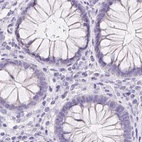 Immunohistochemical staining of human colon using Anti-ASGR2 antibody HPA014899.