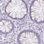 Immunohistochemical staining of human colon using Anti-ASGR2 antibody HPA014899.