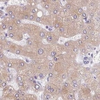Immunohistochemical staining of human liver using Anti-ASGR2 antibody HPA014899.