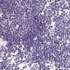Immunohistochemical staining of human lymph node using Anti-ASGR2 antibody HPA014899.
