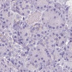 Immunohistochemical staining of human pancreas using Anti-ASGR2 antibody HPA014899.
