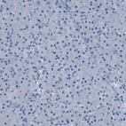 Immunohistochemical staining of human pancreas shows no positivity as expected.