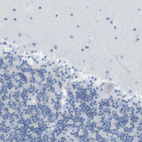 Immunohistochemical staining of human cerebellum shows no positivity as expected.