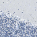 Immunohistochemical staining of human cerebellum shows no positivity as expected.