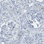Immunohistochemical staining of human kidney shows no positivity as expected.