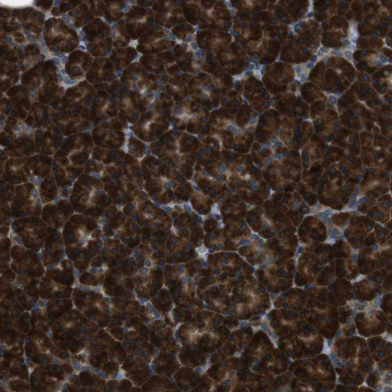 Anti-SSR3 Antibody