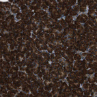 Anti-SSR3 Antibody