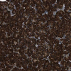 Anti-SSR3 Antibody