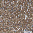 Immunohistochemical staining of human liver shows strong granular cytoplasmic positivity in hepatocytes.