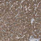 Immunohistochemical staining of human liver shows strong granular cytoplasmic positivity in hepatocytes.