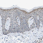 Immunohistochemical staining of human skin shows weak membranous and cytoplasmic positivity in superficial layer of squamous epithelial cells.