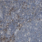 Immunohistochemical staining of human lymphoid tissues shows moderate cytoplasmic positivity in non-germinal center cells.