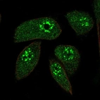 Immunofluorescent staining of human cell line RPTEC TERT1 shows localization to nuclear speckles & cytosol.