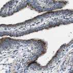 Immunohistochemical staining of human fallopian tube shows moderate to strong positivity in golgi apparatus in glandular cells.