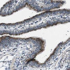 Immunohistochemical staining of human fallopian tube shows moderate to strong positivity in golgi apparatus in glandular cells.