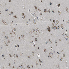 Immunohistochemical staining of human cerebral cortex shows moderate to strong granular cytoplasmic positivity in neuronal cells.