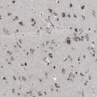 Immunohistochemical staining of human cerebral cortex shows moderate to strong granular cytoplasmic positivity in neuronal cells.