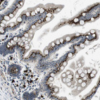 Immunohistochemical staining of human small intestine shows moderate to strong positivity in golgi apparatus in glandular cells.