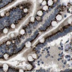Immunohistochemical staining of human colon using Anti-ZFPL1 antibody HPA014909.