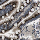 Immunohistochemical staining of human colon using Anti-ZFPL1 antibody HPA014909.