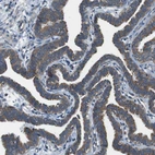 Immunohistochemical staining of human fallopian tube shows moderate cytoplasmic positivity in glandular cells.