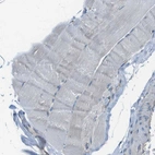 Immunohistochemical staining of human skeletal muscle shows no positivity in myocytes as expected.