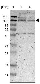 Lane 1: Marker [kDa] 230, 130, 95, 72, 56, 36, 28, 17, 11_br/_Lane 2: Human cell line RT-4_br/_Lane 3: Human cell line U-251MG sp