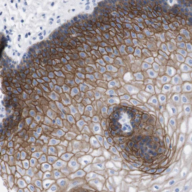 Anti-TMEM243 Antibody