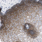 Anti-TMEM243 Antibody