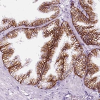 Immunohistochemical staining of human prostate shows membranous positivity in glandular cells.
