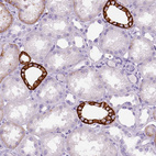 Immunohistochemical staining of human kidney shows membranous positivity in cells in distal tubules.