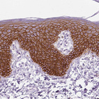 Immunohistochemical staining of human skin shows membranous positivity in epidermal cells.
