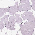 Immunohistochemical staining of human skeletal muscle shows no positivity in myocytes as expected.