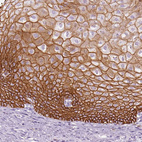 Immunohistochemical staining of human esophagus shows membranous positivity in squamous epithelial cells.