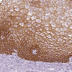 Immunohistochemical staining of human esophagus shows membranous positivity in squamous epithelial cells.