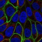 Immunofluorescent staining of human cell line RT4 shows localization to plasma membrane.
