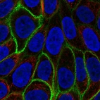 Immunofluorescent staining of human cell line RT4 shows localization to plasma membrane.