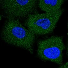 Immunofluorescent staining of human cell line A549 shows localization to cytosol.