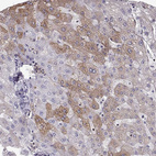 Immunohistochemical staining of human liver shows moderate cytoplasmic and membranous positivity in hepatocytes.