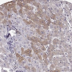 Immunohistochemical staining of human liver shows moderate cytoplasmic and membranous positivity in hepatocytes.