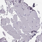 Immunohistochemical staining of human skeletal muscle shows no positivity in myocytes as expected.