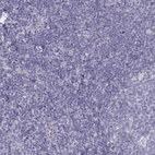 Immunohistochemical staining of human tonsil shows no positivity in non-germinal center cells as expected.