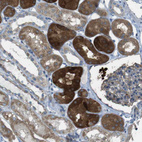 Immunohistochemical staining of human Kidney shows strong granular cytoplasmic positivity in cells in tubules.