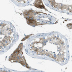 Immunohistochemical staining of human Testis shows moderate granular cytoplasmic positivity in Leydig cells.