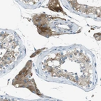 Immunohistochemical staining of human Testis shows moderate granular cytoplasmic positivity in Leydig cells.