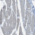 Immunohistochemical staining of human Skeletal muscle shows no granular cytoplasmic positivity in myocytes as expected.