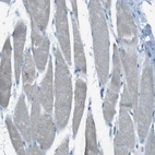 Immunohistochemical staining of human Skeletal muscle shows no granular cytoplasmic positivity in myocytes as expected.