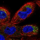 Immunofluorescent staining of human cell line A-431 shows localization to peroxisomes.