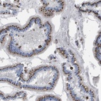 Anti-SLC37A2 Antibody