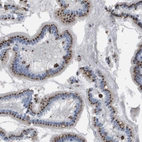 Anti-SLC37A2 Antibody